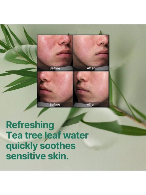 AHA BHA PHA 30 Days Miracle Cream - 2.02oz, 60ml - Mild Exfoliating Salicylic Acid & Centella Face Moisturizer for All Skin Types - Daily Soothing & Clarifying Face Cream - Korean Skin Care