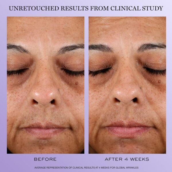 Lancôme Rénergie H.P.N. 300-Peptide Anti-Aging Face Cream with Hyaluronic Acid, Niacinamide & 300 Peptides - Visibly Reduces Wrinkles, Dark Spots & Sagging Skin