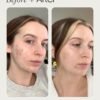Topicals Faded Brightening and Clearing Serum | Reduces Discoloration, Scars, and Spots | Contains Kojic Acid and Niacinamide |Dermatologist-tested, Cruelty-Free (0.5 Fl Oz)
