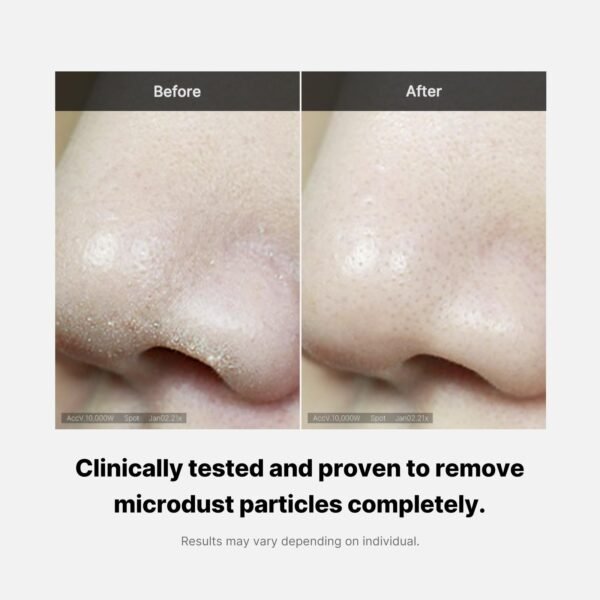 Medicube Zero Foam Cleanser for Sensitive Skin - Sebum Control, Moisture Balance, and Pore Minimization | Korean Skincare